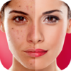 Face Blemishes Cleaner & Photo Scars Remover 1.3